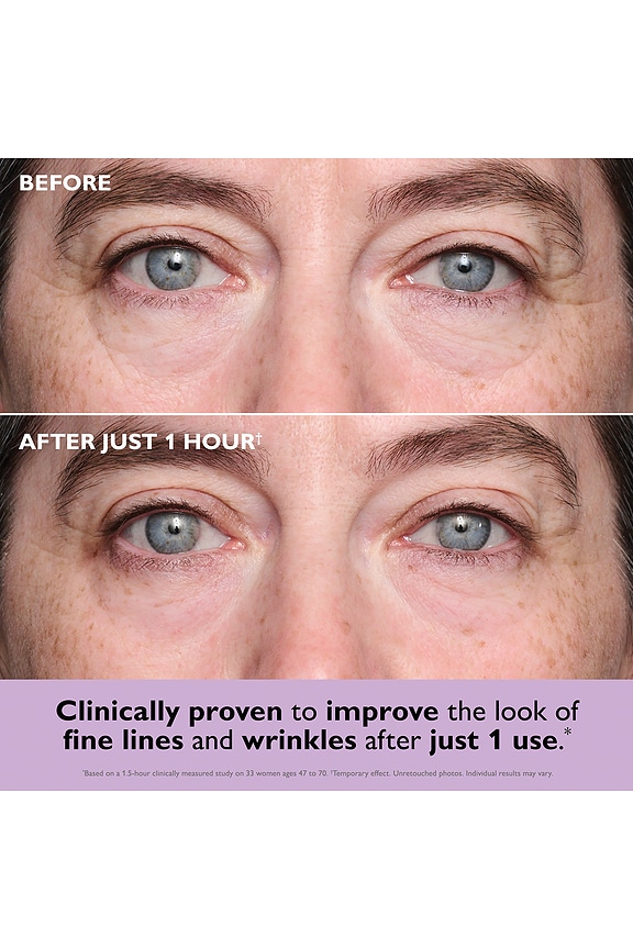 view 2 of 5 Instant FirmX Collagen-Infusion Tightening Eye Patches in 