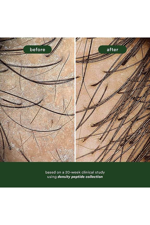 view 2 of 10 Density Peptide Hair Serum in 