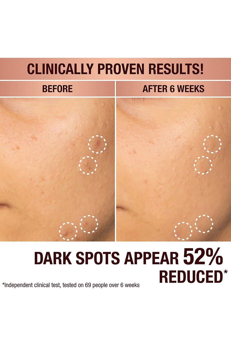 Dark Spot Correcting Radiance Recovery Serum 10ml - thumbnail 3