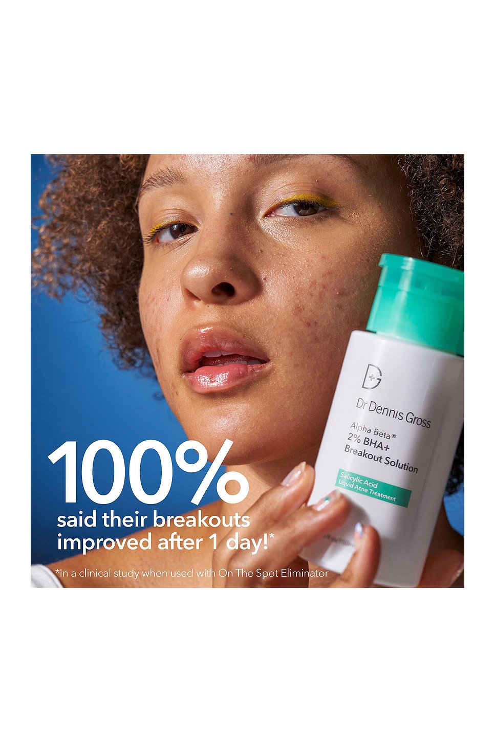 Alpha Beta 2% Bha+ Breakout Solution - thumbnail 3