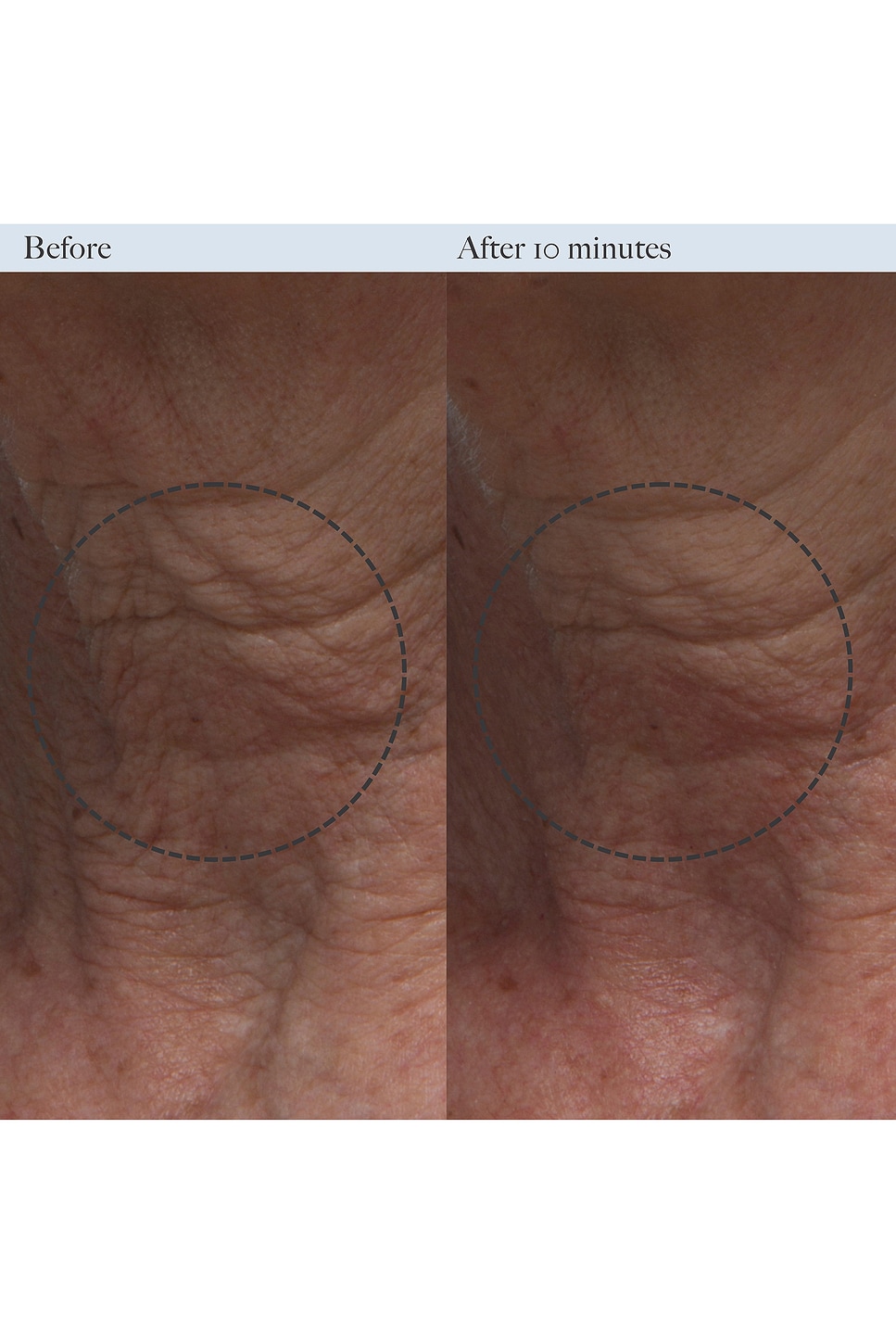 Resurfacing Enzyme Polish - thumbnail 3