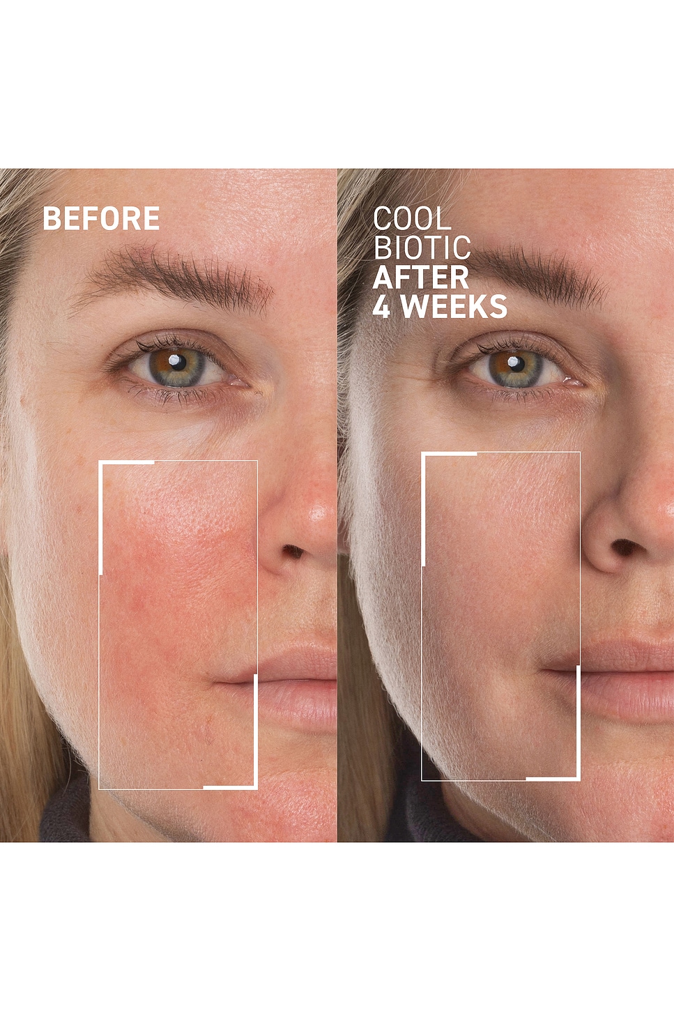Cool Biotic Prebiotic Redness Relief Cream - thumbnail 3