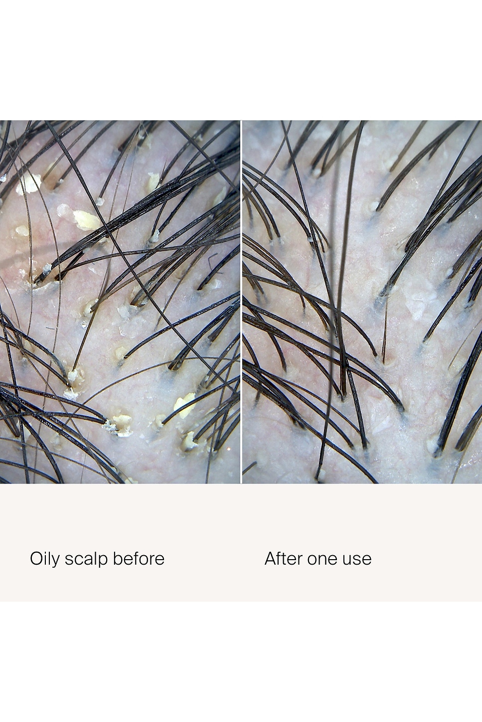 Scalp Care Exfoliator 3.4oz - thumbnail 3