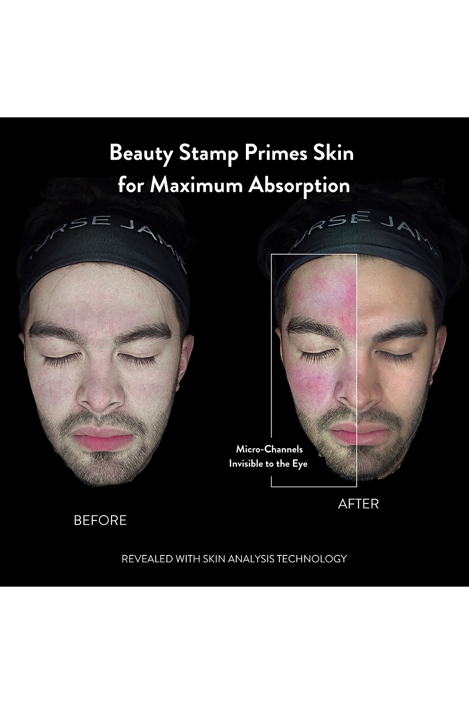 Nurse Jamie Beauty Stamp Micro-Exfoliation Tool
