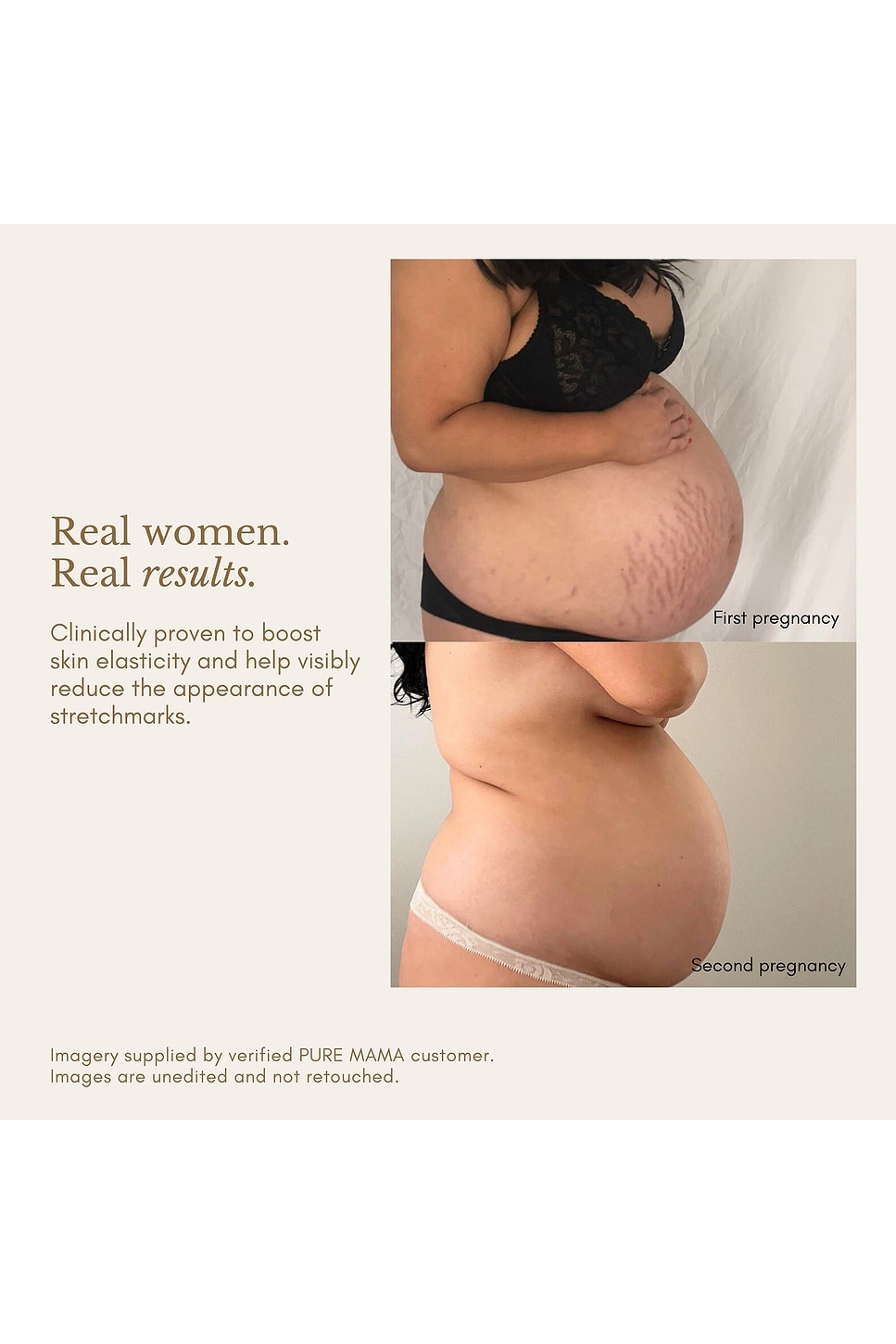 LOT DE SOINS POUR LA GROSSESSE PREGNANCY CARE SET