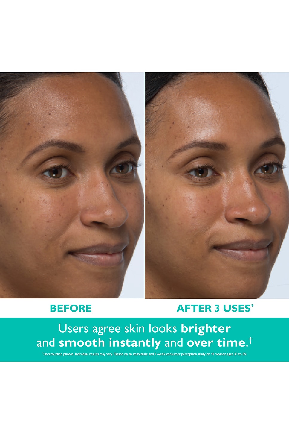 Even Smoother Instant Reveal Facial Peel - thumbnail 3