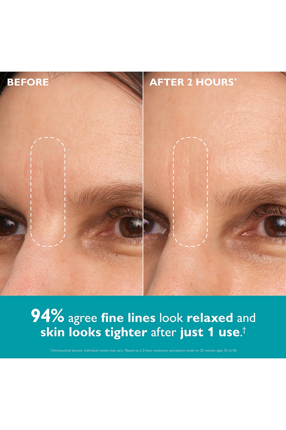 Peptide Skinjection Peptide-Infused Face Tape - thumbnail 3
