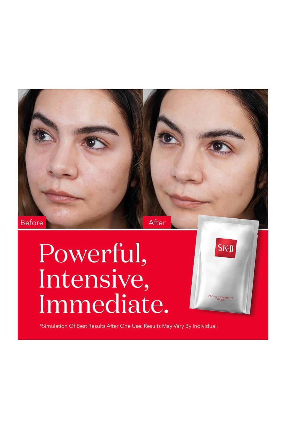 SK-II Pitera Facial Treatment Mask Twin Pack | REVOLVE